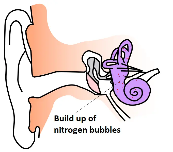 inner ear decompression sickness